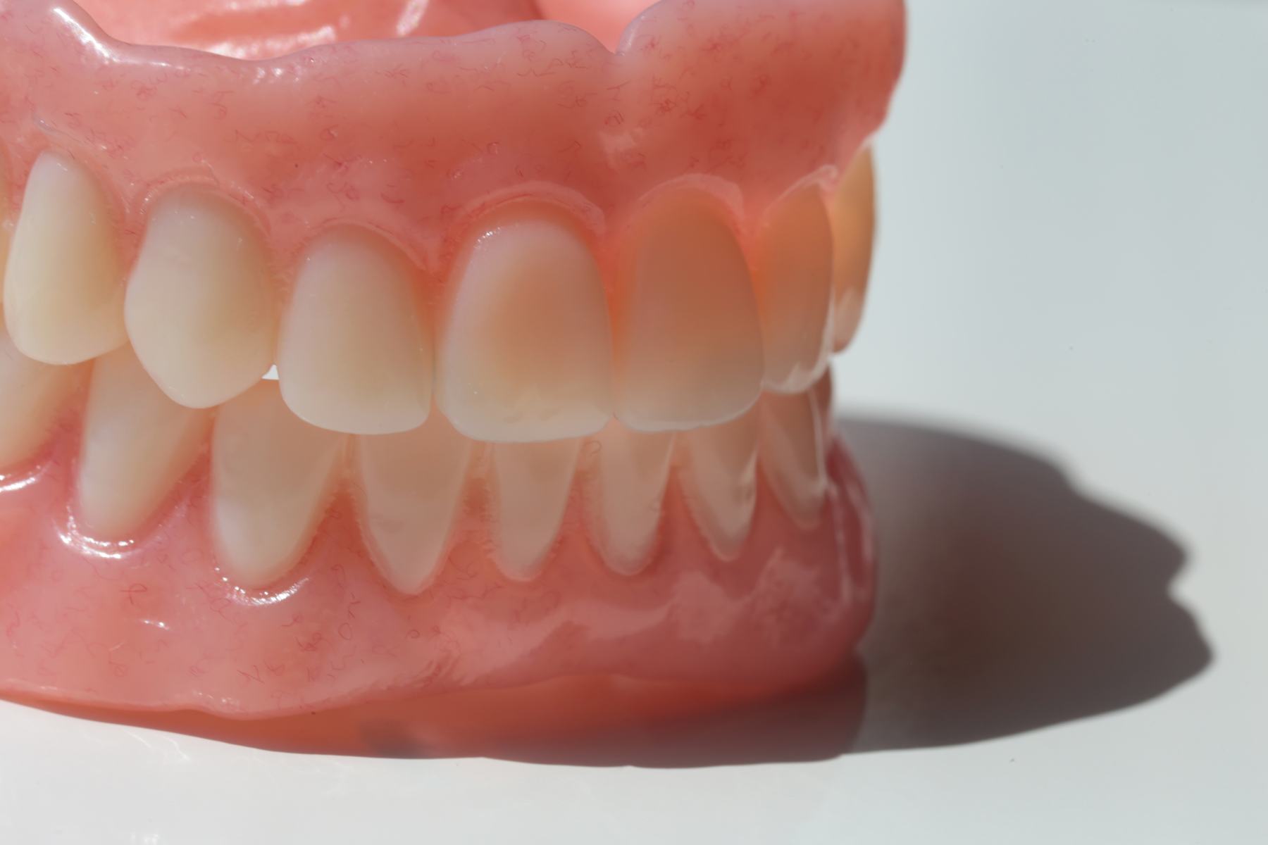 Close-up of a denture fitting surface