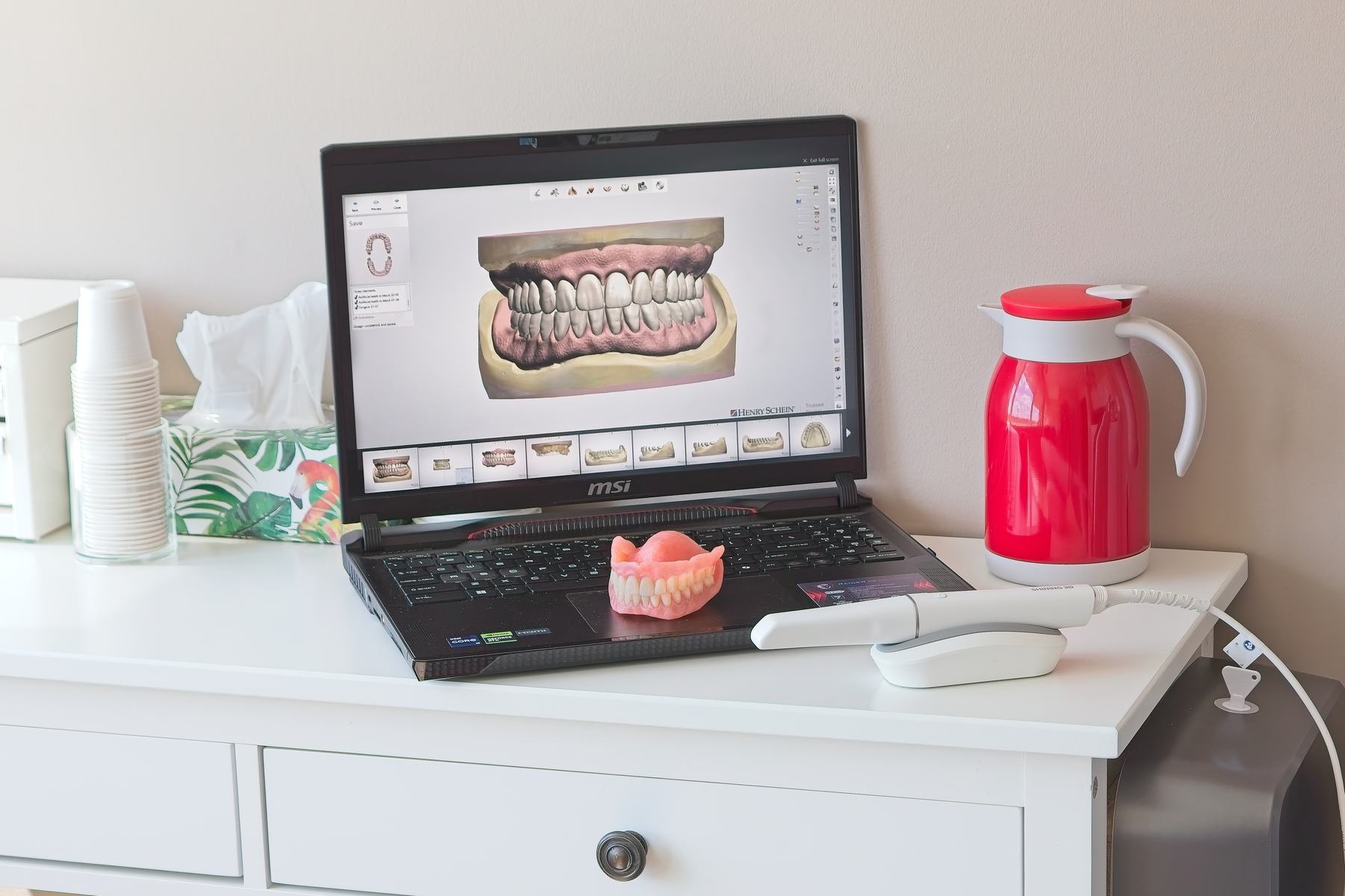 A digitally designed denture on screen beside the finished denture