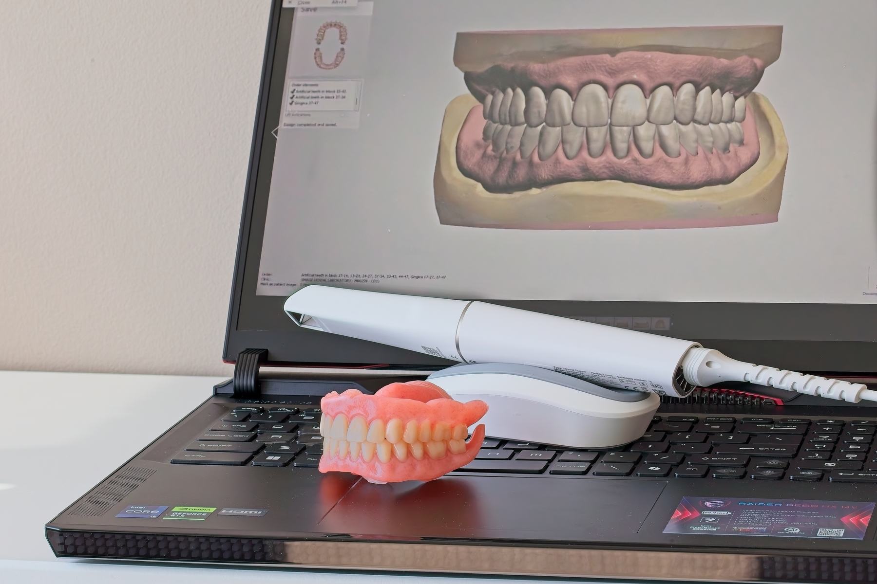 Intraoral scanner and digital denture design on a laptop